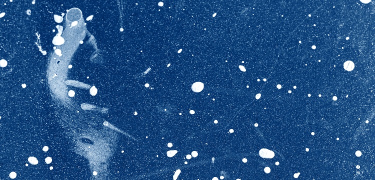 彈力繩檢測(cè)