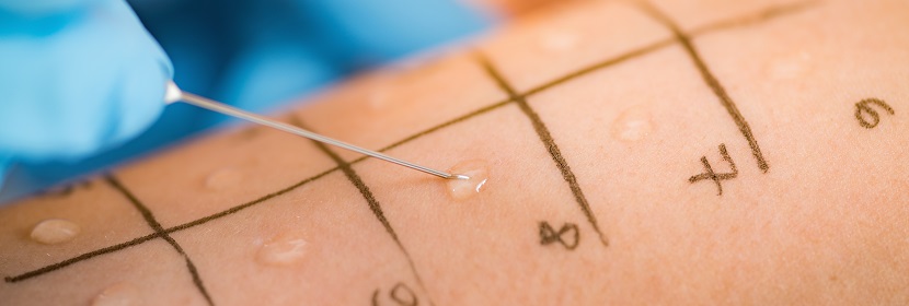 化學(xué)品皮膚致敏試驗(yàn)