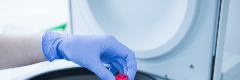 塑料阻燃抗沖擊聚苯乙烯專用料檢測(cè)